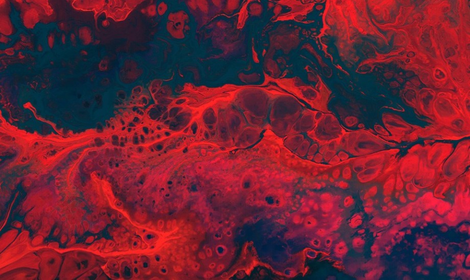 Hemochromatoza - nadmiar żelaza