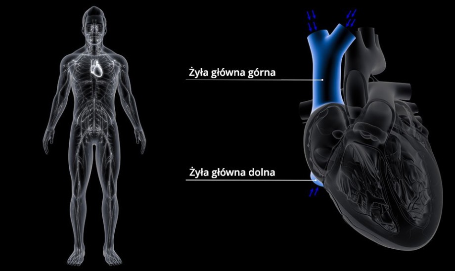 Zespół żyły głównej górnej