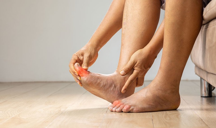 Kryształy moczanu sodu w stawach