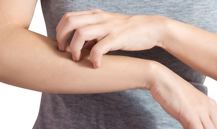 Atopowe zapalenie skóry